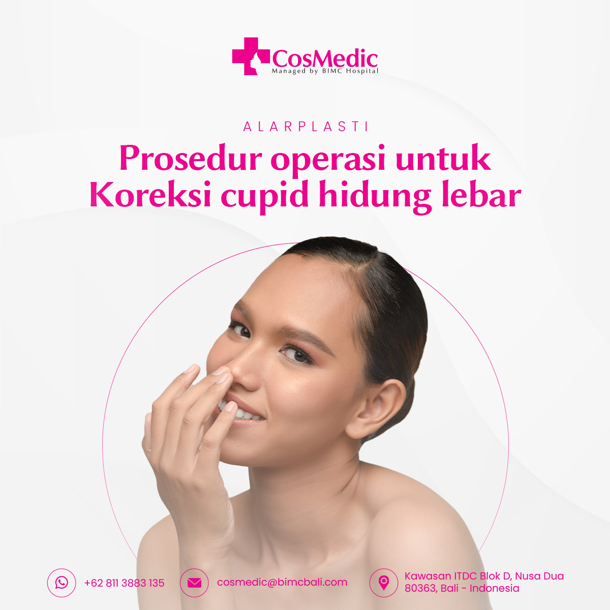 Alarplasti Prosedur operasi untuk Koreksi cupid hidung lebar